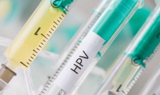 hpv52高危型应注意什么 hpv阳性应注意什么