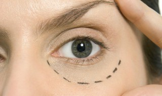 眼袋消除小妙招 如何消除眼袋