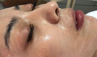 淡化黑眼圈的方法 淡化黑眼圈的方法有哪些