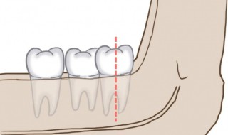 智齿为什么会疼 智齿会疼的原因