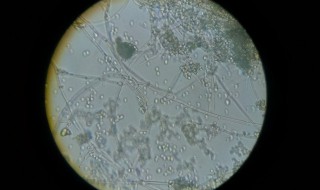 什么是蛋白质的盐析 蛋白质的盐析简单介绍