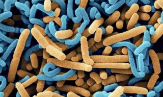 益生菌的副作用 看看有什么副作用