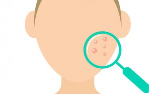 红痘印一般多久会消失 痤疮的红印多久才会消