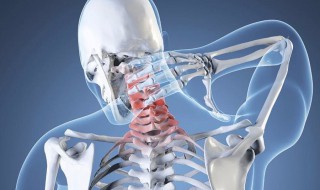 重度颈椎病症状有哪些 重度颈椎病的四种症状