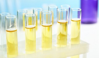 尿液发黄吃什么消炎药 尿尿发黄吃什么药好