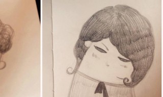 甲状腺肿大挂什么科 领床上女性多患这种病