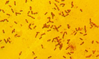 乳酸菌的危害 你知道多少呢