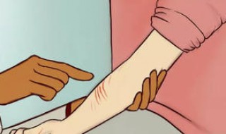 狂犬病的伤口什么颜色 狂犬病的伤口是什么样子的