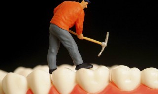 镶牙要磨两边牙的危害 你有镶牙吗