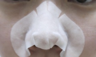 鼻子去黑头最有效的方法 去黑头最有效的方法分享