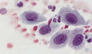 上皮细胞是什么意思 上皮细胞意思介绍