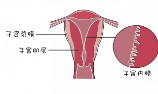 子宫松弛的症状 宫颈松弛有什么症状