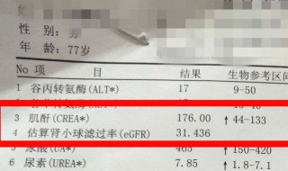 肌酐159严重吗 血肌酐159正常吗