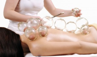 拔火罐窍门 拔火罐技巧