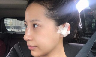 鼻头大缩小自然方法 关于鼻头大缩小自然方法