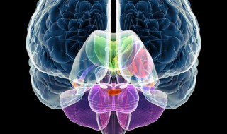 多发性腔隙性脑梗塞有哪些症状 腔隙性脑梗死有哪些表现