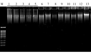 电泳图是什么 什么是电泳图