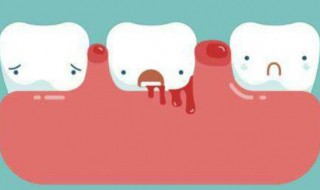 牙龈出血吃什么好 牙龈出血吃哪些食物好