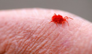 虱子是怎么长出来的 虱子是怎么产生的