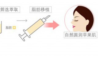 苹果肌太大怎么办 具体方法如下