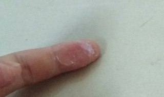 手上沾了胶水用什么可以洗掉 用什么可以洗掉手上的胶水