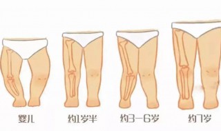 o型腿怎么改善 有效的方法如下