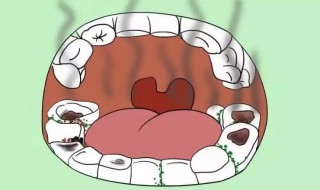 如何预防宝宝口臭 预防宝宝口臭方法