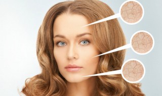 怎样证明自己是过敏体质 如何证明自己是过敏体质