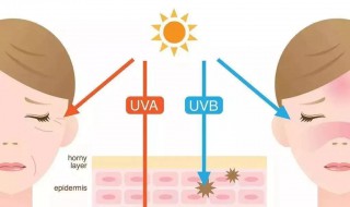 皮肤晒伤后美白的方法 皮肤晒伤后美白的方法分享