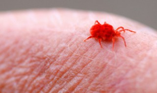 猫蚤咬了怎么处理（被猫身上的跳蚤咬了怎样处理）