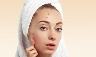 额头上长了很多粉刺如何处理 额头上长了很多粉刺如何处理好