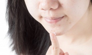 脸太油长小痘痘怎么办 脸上很油长痘痘怎么办怎么调理