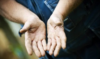 冬季手脸干裂怎么办（冬季手脸干裂怎么办呢）