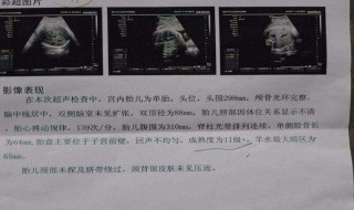 孕早期哪种情况要做B超（孕早期做b超是检查什么）