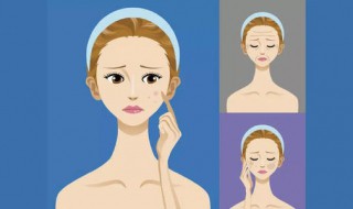 脸上三角区总长痘痘怎么办（脸部三角区长痘痘怎么回事）