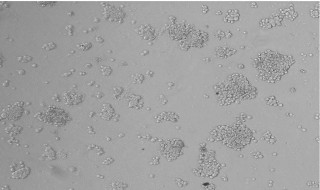 原代培养的特点（原代培养的意义）