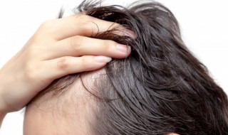 发际线应该怎么修饰 发际线应该怎么修饰才好看