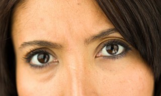 眼圈黑色素沉淀怎么去除（眼圈黑色素沉淀怎么去除方法）