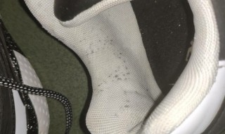 鞋子长霉斑怎么洗掉 鞋子上长霉斑怎么洗掉