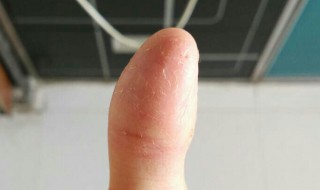 高锰酸钾弄到手上怎么洗掉 高锰酸钾弄到手上怎么洗掉铁锈色