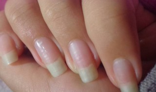 染发剂弄到指甲上怎么洗掉 黑色染发剂弄到指甲上怎么洗掉