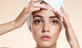 耳朵长痘痘是什么原因（右边耳朵长痘痘是什么原因）