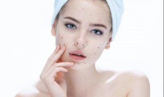 下巴长痘痘快速消除 下巴长痘痘消除小偏方百度百科