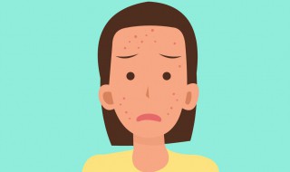 生理期皮肤差怎么办 生理期皮肤变差是怎么回事