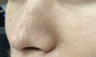 如何收缩鼻头上的毛孔（如何收缩鼻头上的毛孔呢）