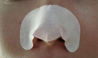 如何去掉鼻子上的黑头 如何去掉鼻子上的黑头物理方法