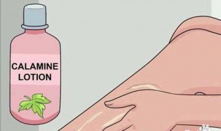 宝宝在乡下老是被跳蚤咬 在乡下被跳蚤咬了怎么办