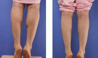 瘦小腿肌肉最有效的方法（瘦小腿肌肉最有效的方法锻炼）