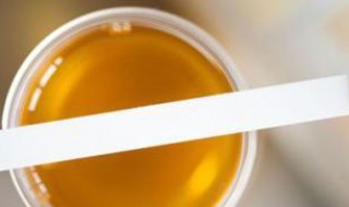 尿浇花正确方法（如何用尿浇花）