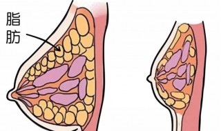 胸部脂肪多怎么减掉 胸部脂肪多怎么减掉最快